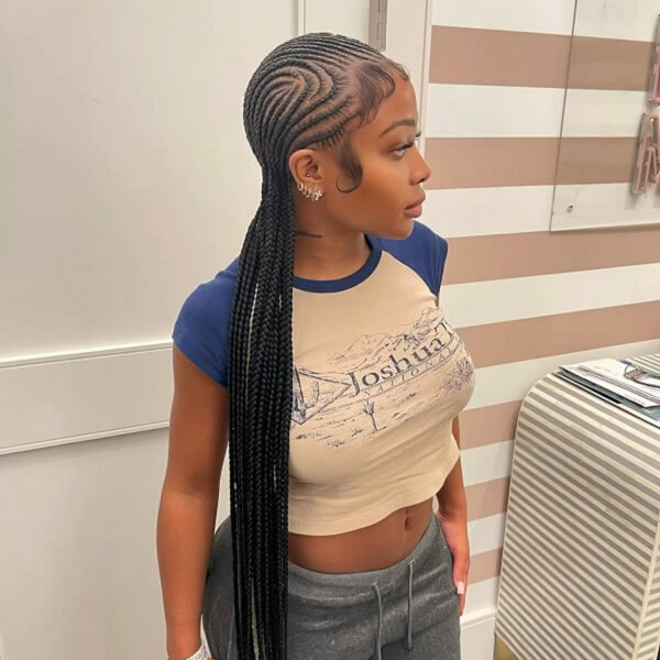 Do Cornrows Pull Your Hairline Back?